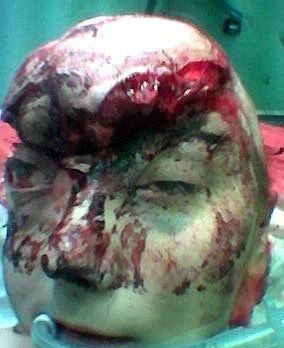 medical-miracle-1.jpg