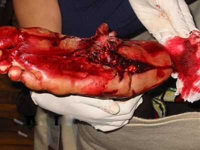 foot-ouch.jpg