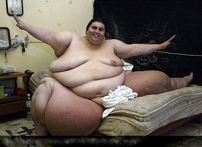 charonboat_dot_com_morbid_obesity.jpg