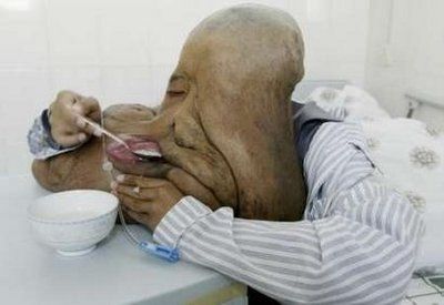 facial-tumors-1.jpg