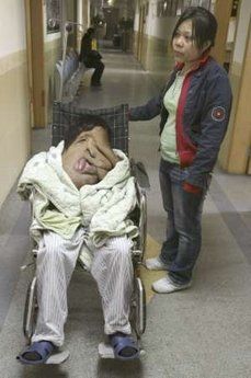 facial-tumors-2.jpg