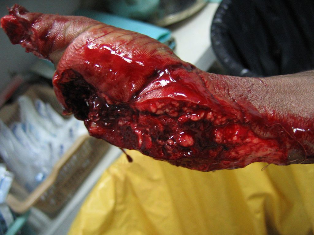 drunk worker hand in machine 2.jpg