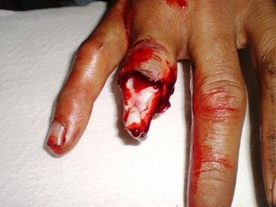 finger.jpg