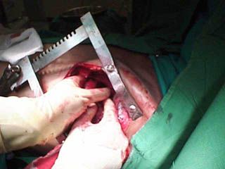 chest3.jpg