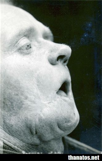 ped5.jpg