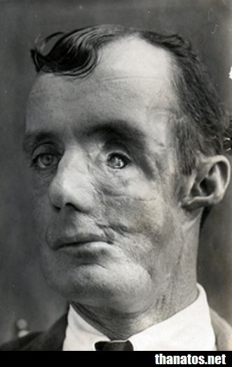 ped6.jpg