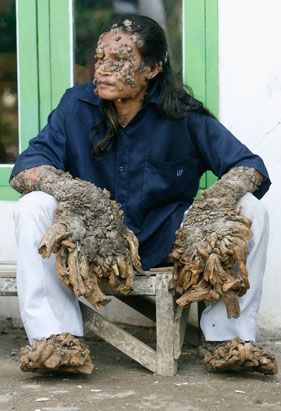 rt_dede_080415_ssv.jpg