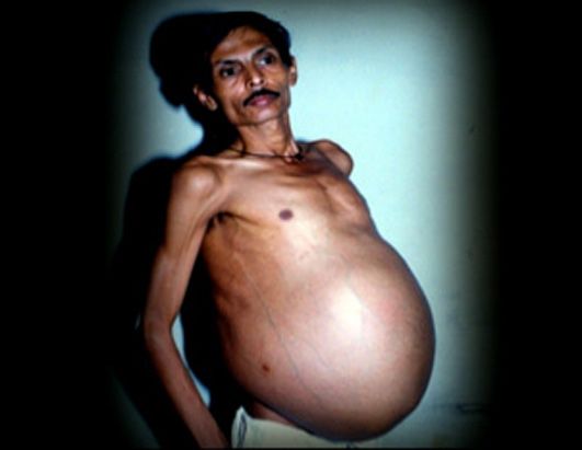 abc_kumar_060824_ssh.jpg