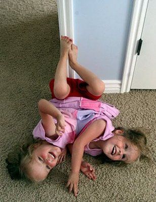 ap_conjoined_060804_ssv.jpg