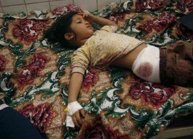 girl_wounded_by_us_forces.jpg