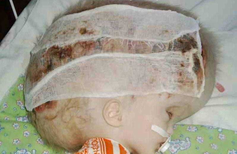 babyhead3.jpg