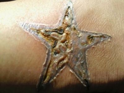 infected-20tattoo.jpg