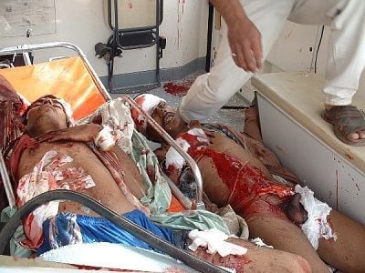 7ambulance1_2patients.jpg