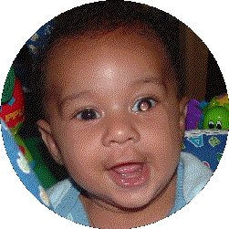 retinoblastoma1.gif