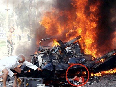 Baby boy survives Islamic terrorist car bomb.jpg