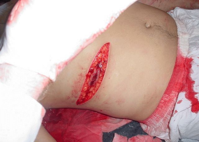 knife-fight-2.jpg