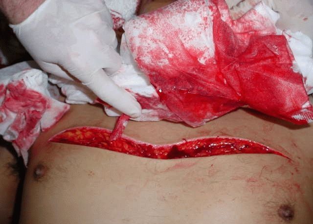 knife-fight-3.jpg