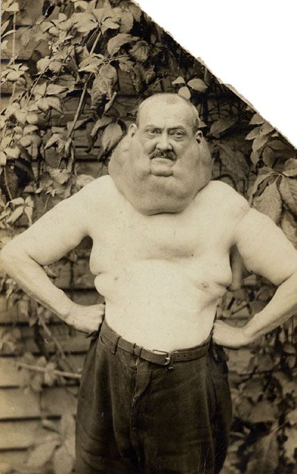 banjo-goiter-2.jpg