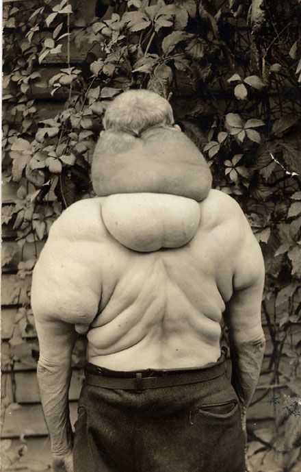 banjo-goiter-4.jpg