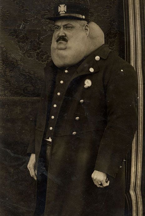 banjo-goiter-5.jpg