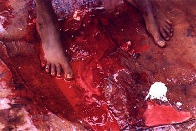 fgm-blood-loss.jpg