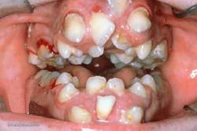 teethdental.jpg