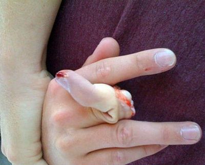 fingerbend.jpg