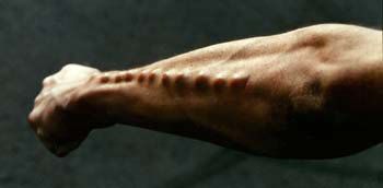 spikes_in_arm.jpg