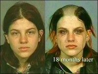 methaddict-teen.jpg