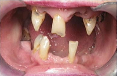 speed_meth_user_teeth_1.jpg