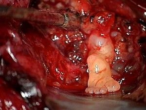 brain-foot-300x225.jpg
