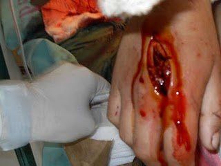 stabbed1.jpg