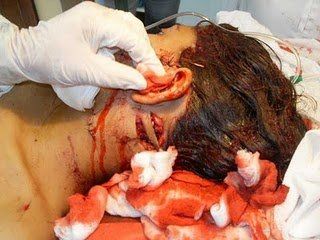 stabbed3.jpg