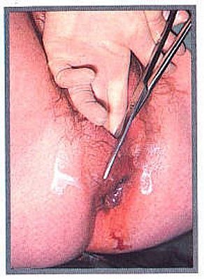 breechhospital3.jpg