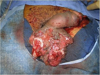penetratingtraumairqifr.jpg