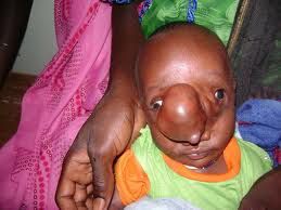 nosecancer8.jpg