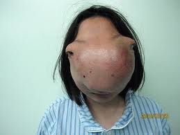 nosecancer9.jpg