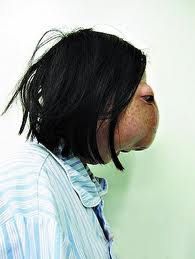 nosecancer10.jpg