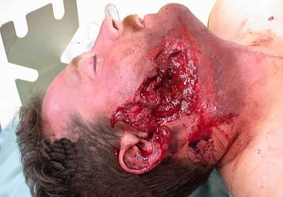 injury.jpg