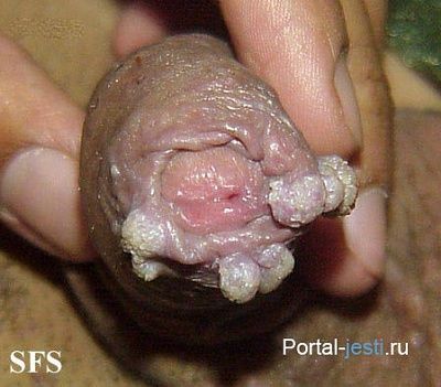 penis.jpg