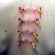 Surface_Piercing_Rejection-9.jpg