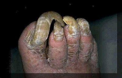 gross1.jpg