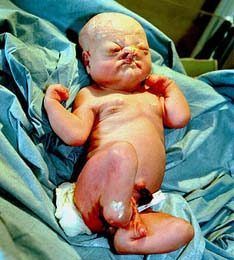 body-abnormalities.jpg