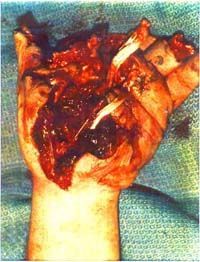 injury4.jpg