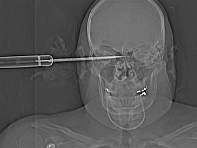 skullknifing.jpg