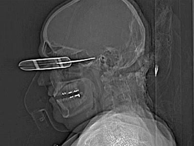 skullknifing2.jpg