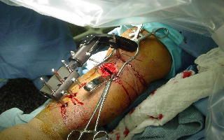 surgery2.jpg