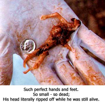 abortion04-1-.jpg