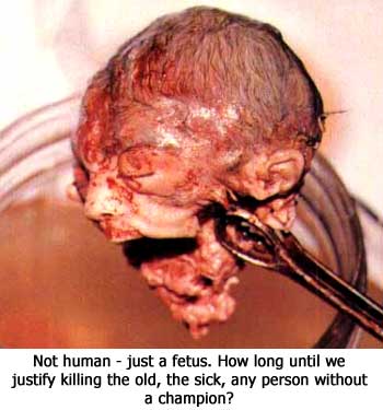 abortion06.jpg