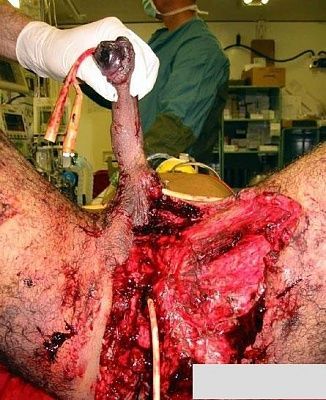 ouchcock.jpg